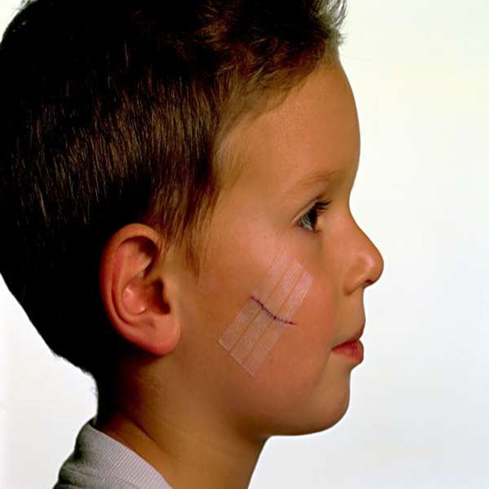 Sutura-Cutanea-Steri-Strip-Ref-1546-Sobre-1-Unidad-imagen-4