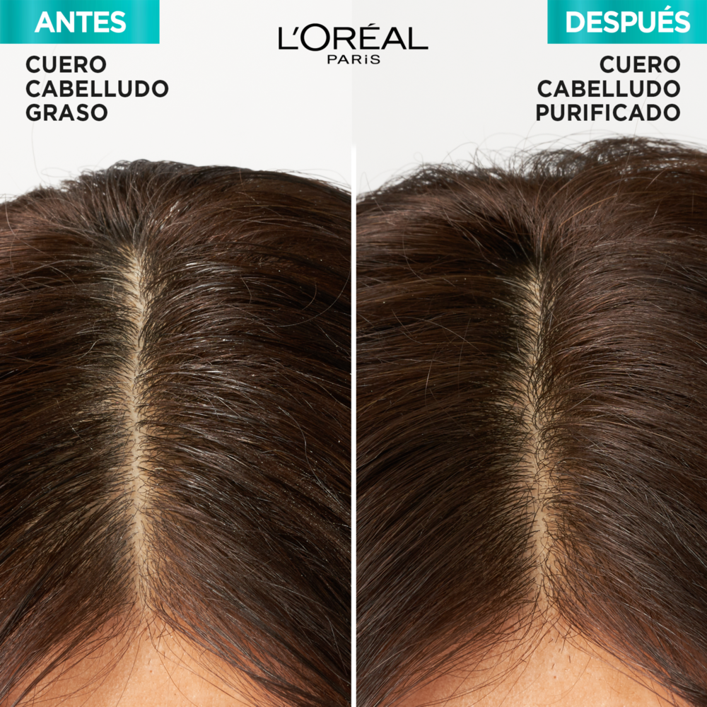 Tratamiento-Capilar-Elvive-L'Oreal-Paris-Hialur&oacute;nico-Pure-Ra&iacute;ces-Grasas-Puntas-Deshidratadas-X300-G-imagen-3