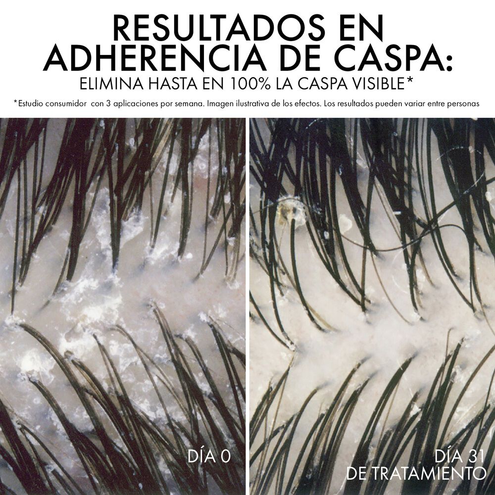 Shampoo-Anticaspa-Vichy-Dercos-Refill-390Ml-imagen-2