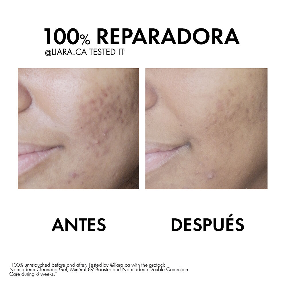 Normaderm-Phytosolution-Doble-Corrección-Uso-Diario-Vichy-50-mL-imagen-5