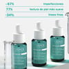 Serum-Hyseac-Uriage-Piel-Nueva-Refuerzo-Anti-Imperfeciones-Fco--30Ml-imagen-4