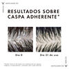 Shampoo-Anticaspa-Vichy-Dercos--390Ml-imagen-5
