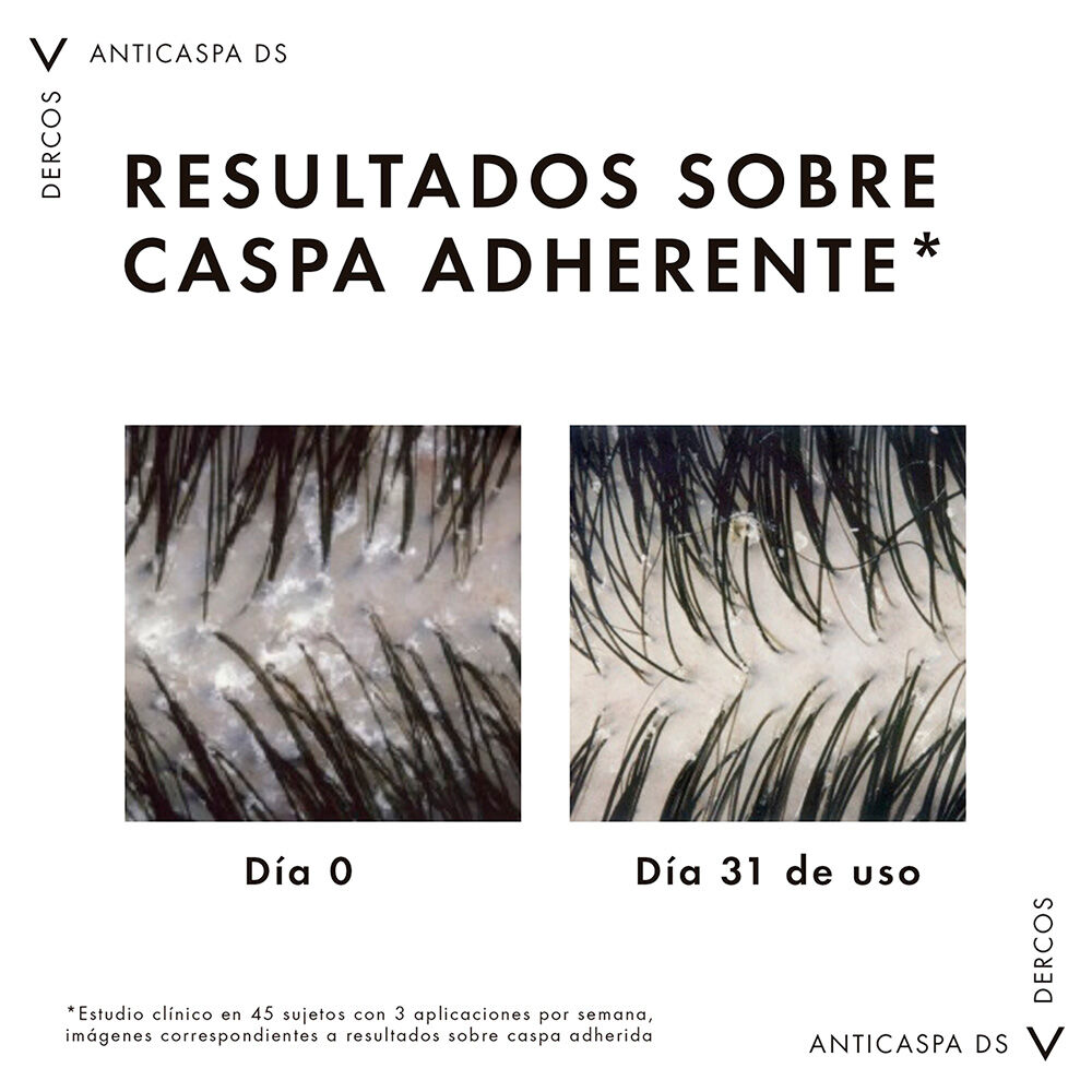 Shampoo-Anticaspa-Vichy-Dercos--390Ml-imagen-5
